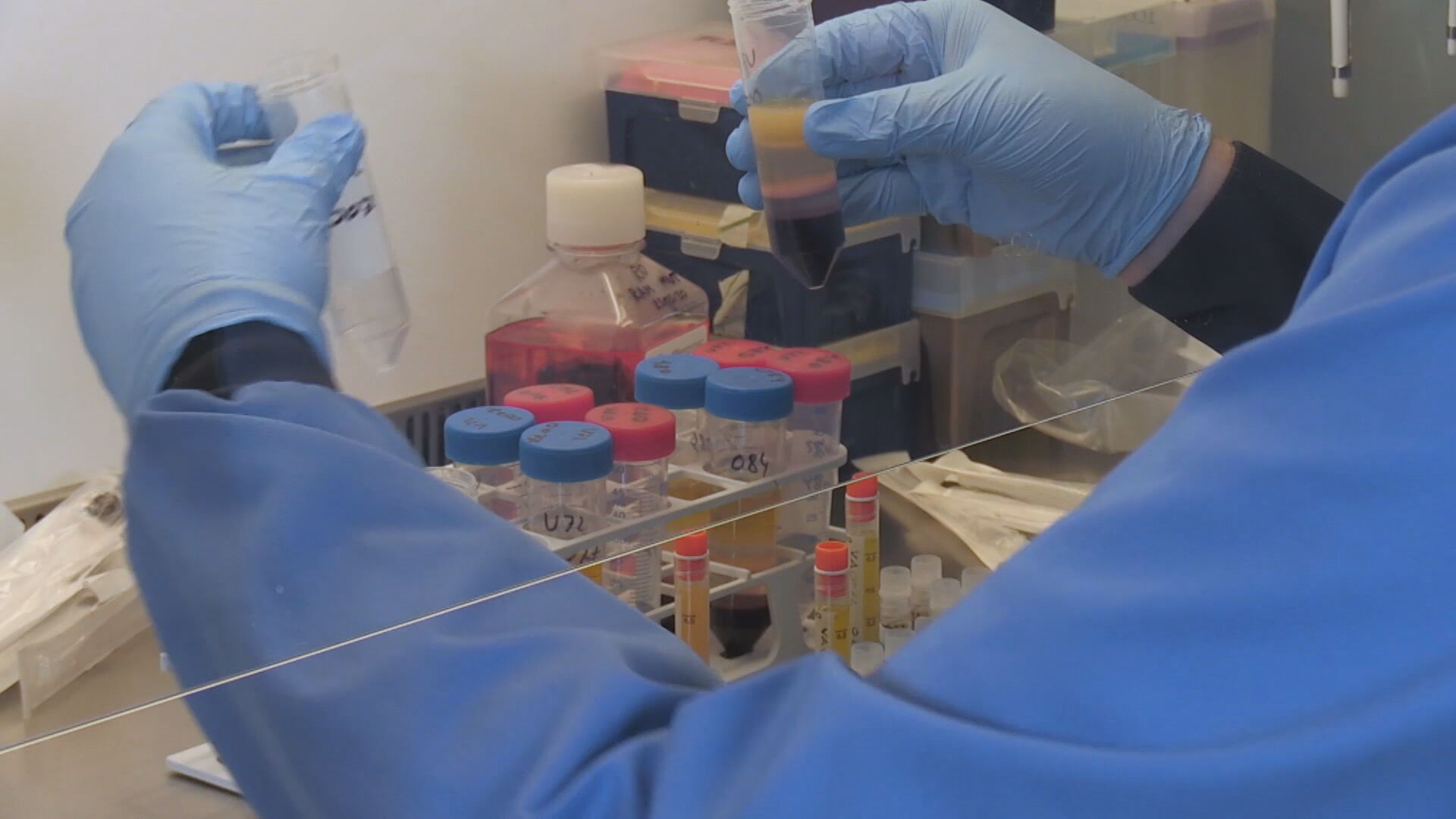 Cientistas brasileiros se destacam na busca por vacinas contra Covid(25.jul.2020