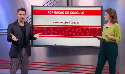 Correspondente Médico: Qual a relação entre trombose venosa cerebral e Covid-19?