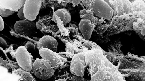 Visão microscópica da Yersinia pestis, bactéria que causa a peste