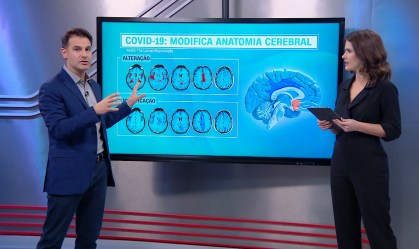 Correspondente Médico: Quais são as consequências da Covid-19 para o cérebro?