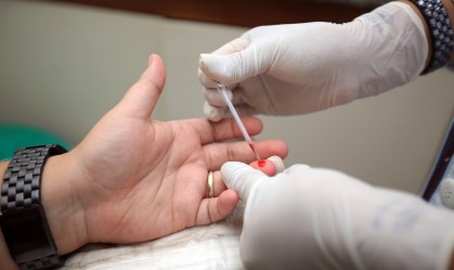 Cura espontânea do HIV é identificada em paciente de 66 anos nos EUA