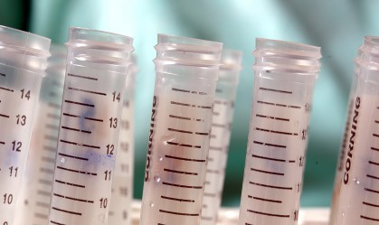 Estudo no Brasil também deve ser retomado, diz instituição responsável por teste