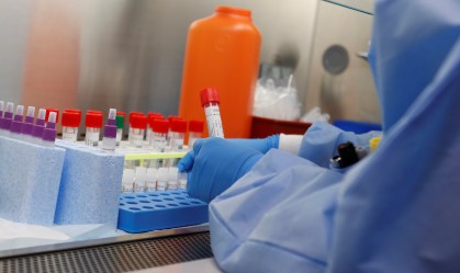 Hidroxicloroquina: EUA testam remédio para malária no tratamento do coronavírus