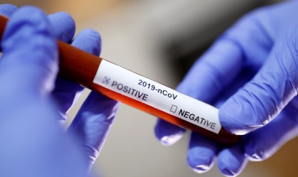 Anvisa faz restrições ao uso de drogas antimalária contra o coronavírus