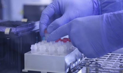 TCU vai apurar testes comprados pela Saúde e que estão perto de vencer