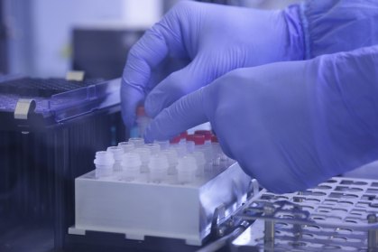 Testes para detecção da Covid-19 analisados no Instituto Oswaldo Cruz