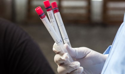 Média semanal de novos casos da Covid-19 atinge recorde no Canadá 