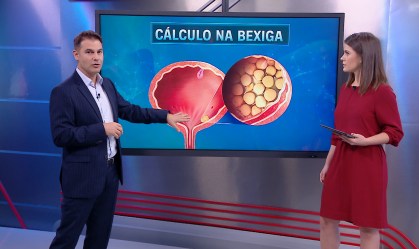 Correspondente Médico: Quais os riscos do cálculo renal e como prevenir?