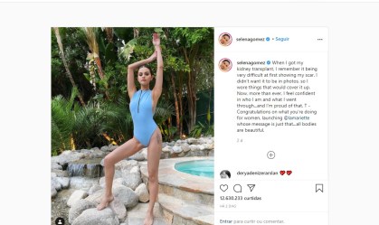 Selena Gomez exibe cicatriz de transplante com orgulho