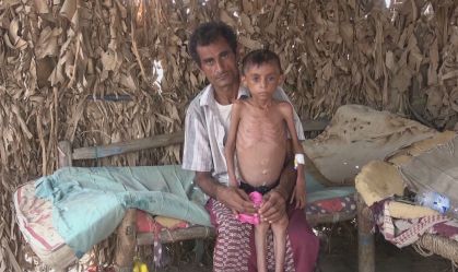 19 milhões de brasileiros vivem com fome; consequências na saúde são irreversíveis