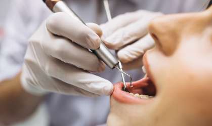 Estresse da pandemia leva a aumento de dentes rachados, dizem dentistas