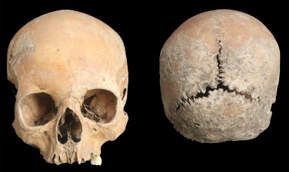 Crânio de 1.200 anos mostra sinais de punições severas na Europa medieval