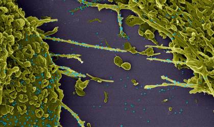 Imagem microscópica mostra novo coronavírus infectando célula