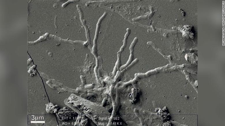 Parte de tecido cerebral vitrificado de jovem que morreu na erupção do Vesúvio