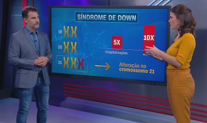 Estudo revela que Covid-19 é 10 vezes mais letal para quem tem síndrome de Down