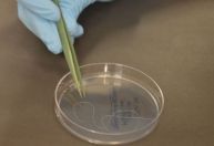 Superfungo: aumento de infecções pode ser causado por mudança climática, avaliam cientistas