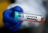 Anvisa aprova uso emergencial de novo coquetel de anticorpos contra Covid-19