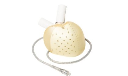 Coração artificial produzido pela Carmat