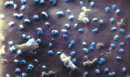 Reinfecções por Covid são raras, mas podem ser mais comuns em idosos, diz estudo