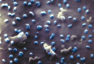 Microscópio fotografa pela 1ª vez a interação do novo coronavírus com células