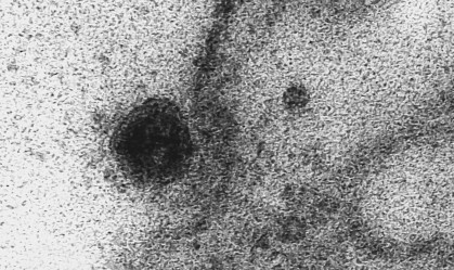 Fiocruz registra momento em que novo coronavírus ataca célula