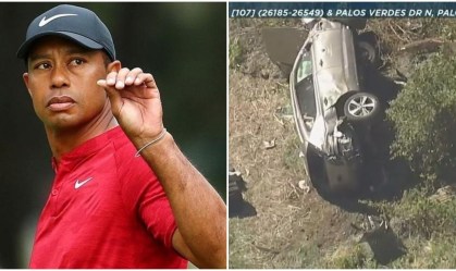 Tiger Woods teve 'ferimentos não fatais' e sofreu fraturas expostas