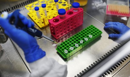 Brasil tem 127 mil testes para COVID-19 ainda pendentes de verificação