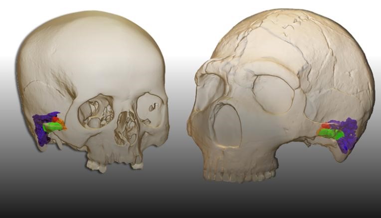 Crânio de neandertal
