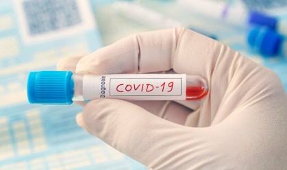 OMS estuda casos de pessoas que testaram positivo para COVID-19 pela segunda vez