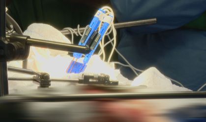 Nova tecnologia é usada para tratar câncer do pâncreas no Brasil (01.mar.2021)