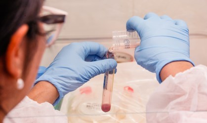 Processamento da amostra e exame de sangue
