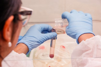 Processamento da amostra e exame de sangue
