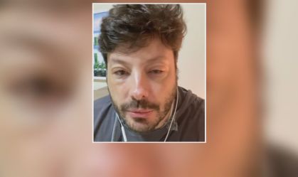 Danilo Gentili tem grave reação alérgica a remédio; médico alerta sobre riscos