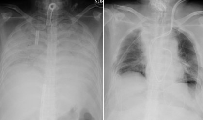Exames de raio-x realizados antes e depois do procedimento