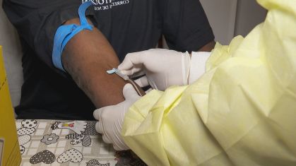 Teste sorológico para identificar pacientes que tiveram contato com a Covid-19