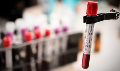 Macacos são imunizados contra novo coronavírus em testes de vacinas