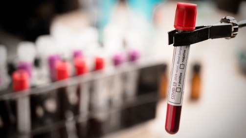 Exame de sangue para a COVID-19