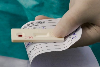 Identificação de teste rápido para detecção de Covid-19