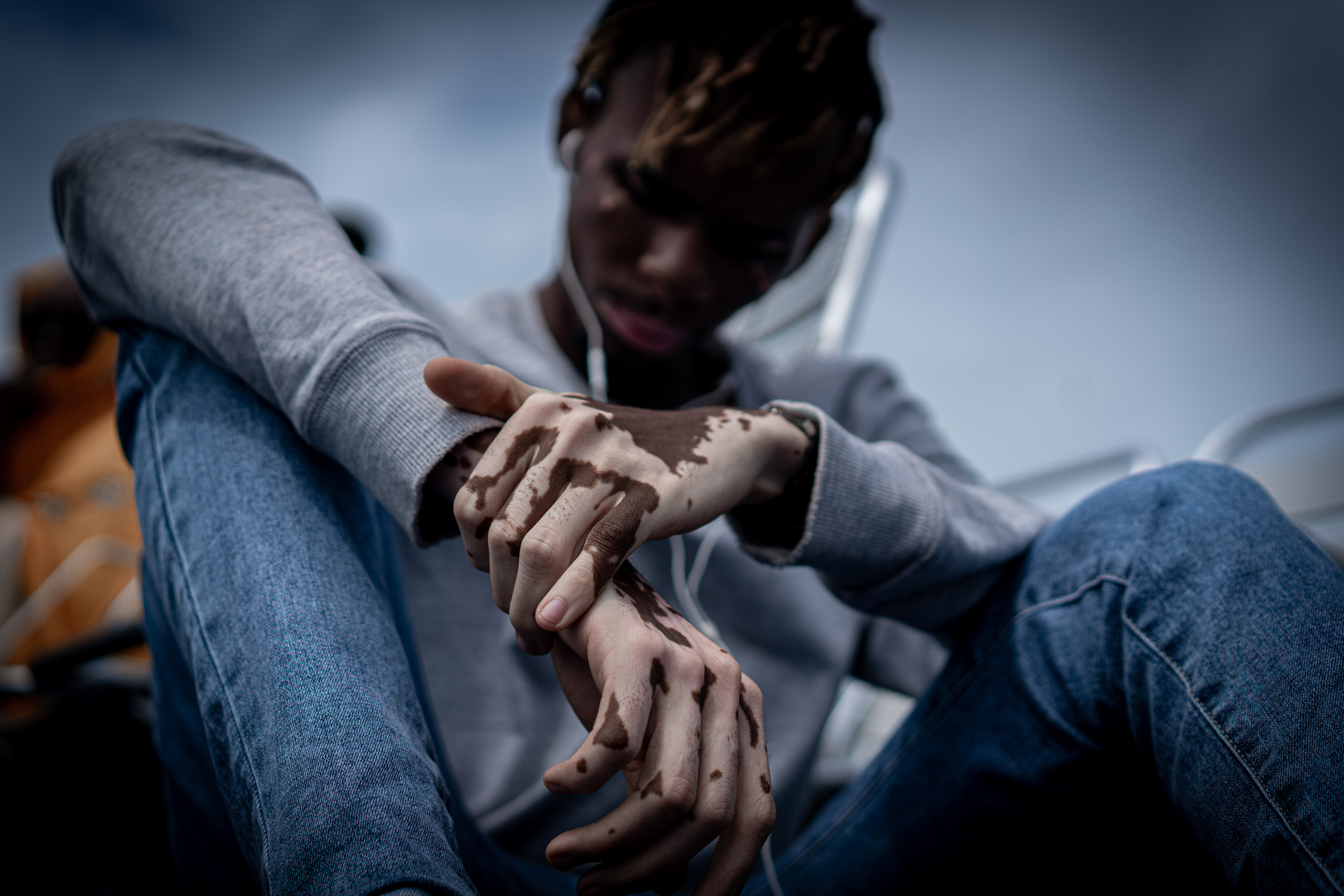 Dia Mundial do Vitiligo, 25 de junho