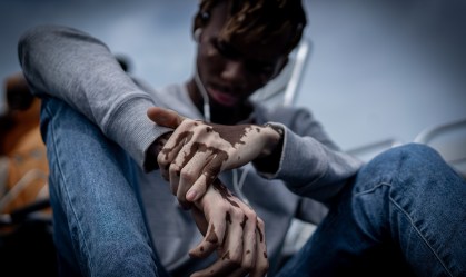 Dia Mundial do Vitiligo alerta para o impacto da doença na saúde mental