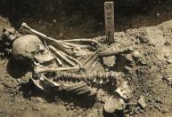 Cientistas descobrem a mais antiga vítima de um ataque de tubarão, de 3 mil anos