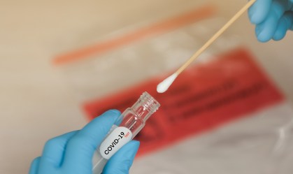 Teste laboratorial de Covid-19.