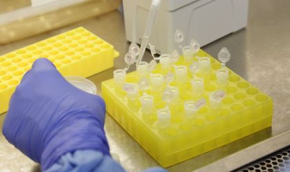 Casos de Síndrome Respiratória Aguda Grave sobem 13% em seis dias no AM