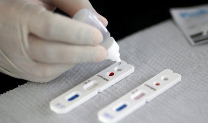 Empresa italiana anuncia aprovação da Anvisa para teste rápido da Covid-19