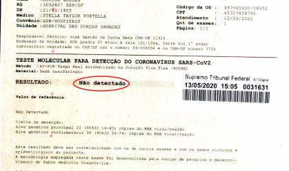 Bolsonaro testou negativo para Covid-19, mostram exames entregues ao STF