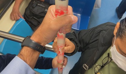 Entenda o risco de contágio do novo coronavírus em ambientes coletivos