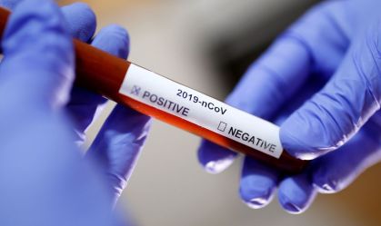 Hospitais adotam protocolo para casos suspeitos de coronavírus