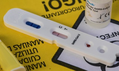Ministério da Saúde confirma mais 34 mil casos e mil mortes por Covid-19 em 24 h