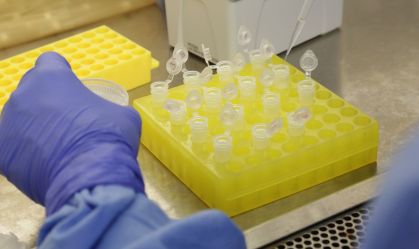 Qual a diferença entre epidemia e pandemia?