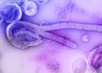 Ebola pode chegar ao Brasil? Saiba o que diz especialista